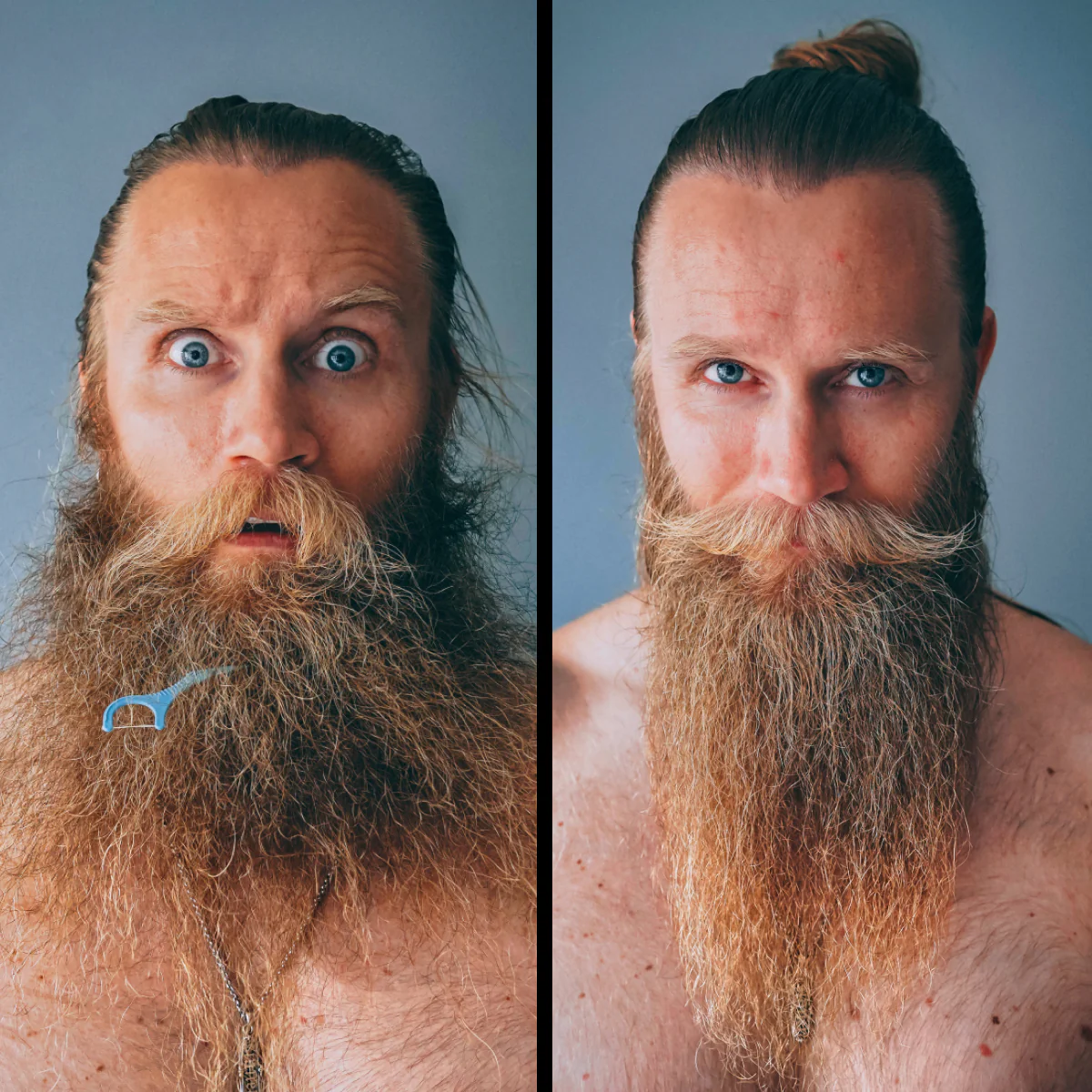 Ultimate Carbon X Beard Kit - Image 4